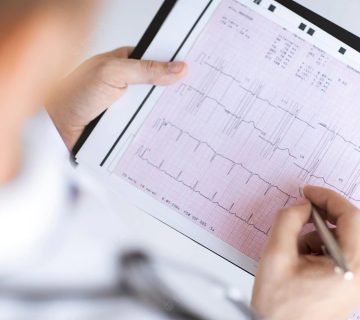 امروزه دستگاه های نوار قلب قابل حمل با دقت بالا همانند دستگاه های مراکز پزشکی جریان الکتریکی تولید شده توسط عضله قلب در هر ضربان را شناسایی می کنند